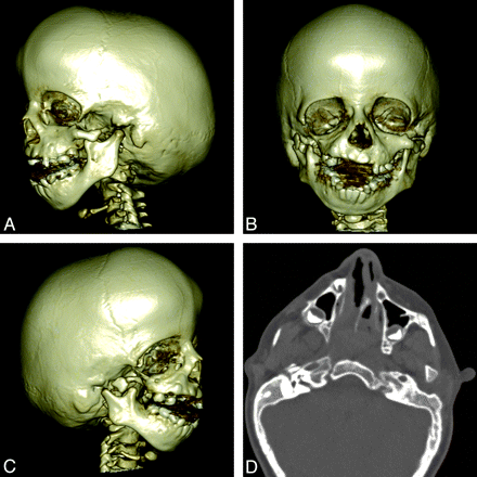 Fig 4.