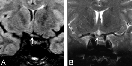 Fig 5.