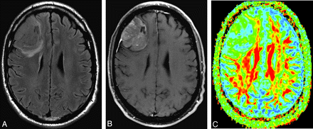 Fig 4.