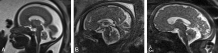 Fig 1.