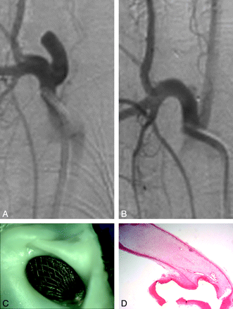 Fig 3.