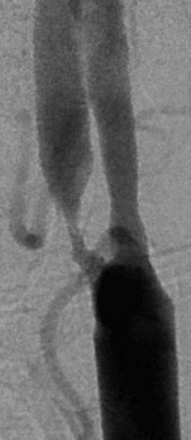 Fig 2.