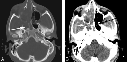 Fig 10.