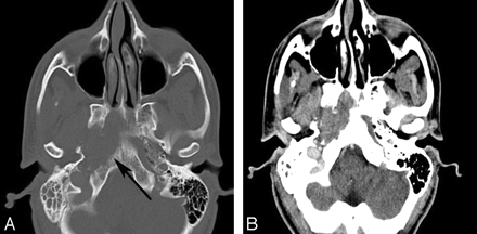 Fig 12.