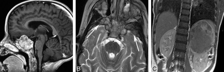 Fig 13.