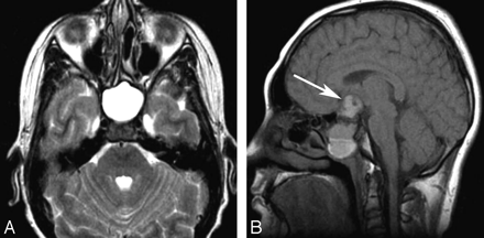 Fig 2.