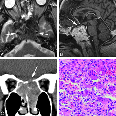 Fig 4.