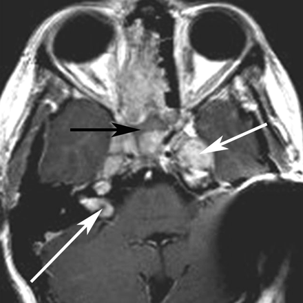 Fig 5.