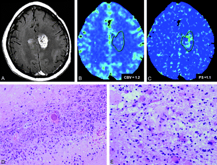 Fig 3.