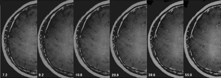 Fig 4.