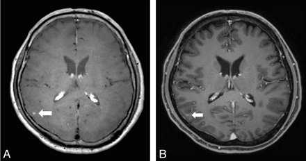 Fig 7.