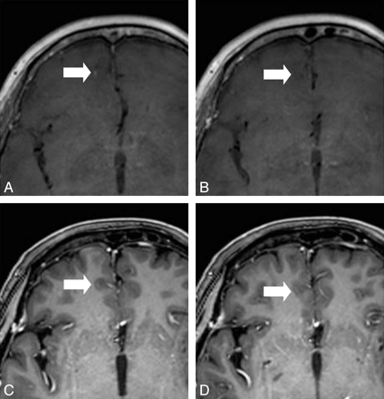 Fig 8.