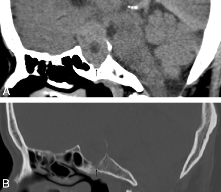 Fig 2.