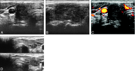 Fig 2.