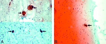 Fig 3.