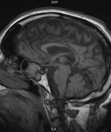 Fig 2.