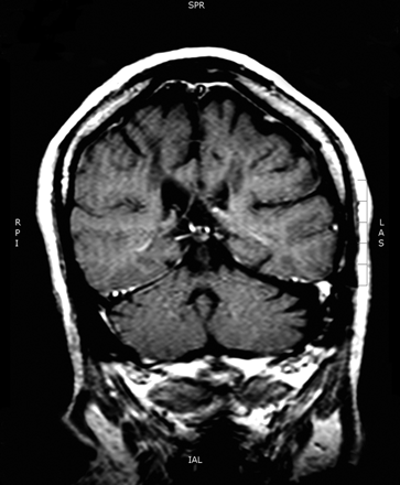 Fig 3.