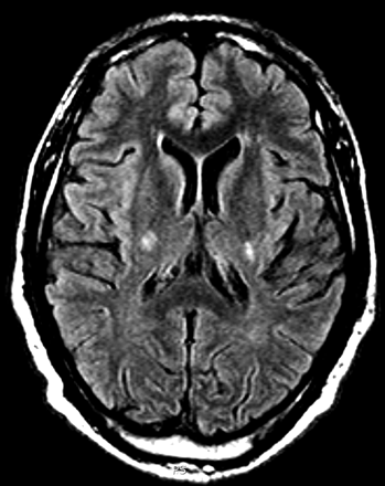 Fig 8.