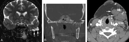 Fig 2.