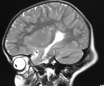 Fig 1.