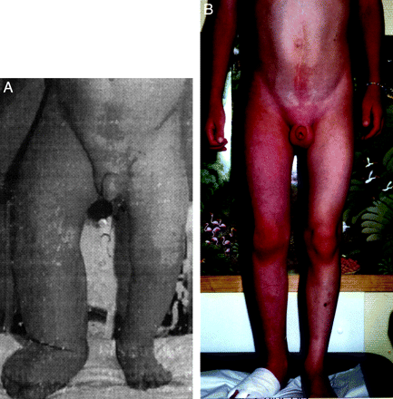 Fig 2.
