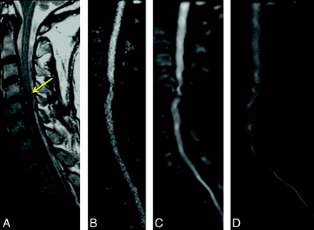 Fig 5.