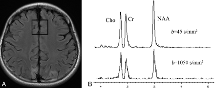 Fig 2.