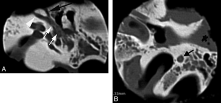 Fig 1.