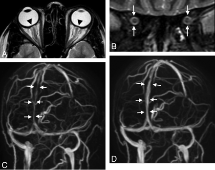 Fig 2.