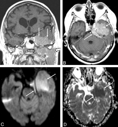 Fig 4.