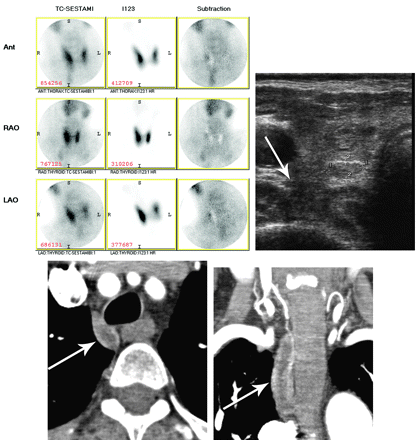 Fig 2.