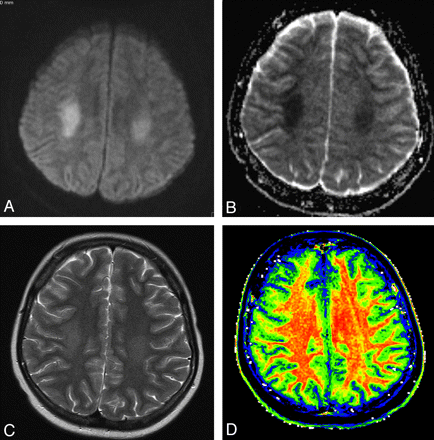 Fig 1.