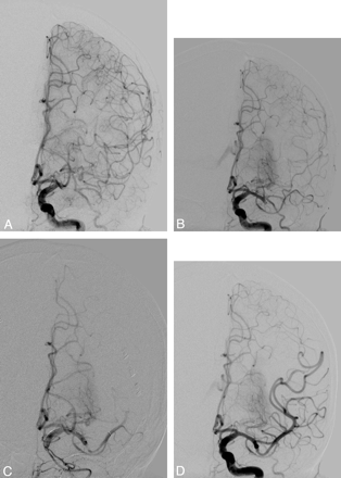 Fig 1.