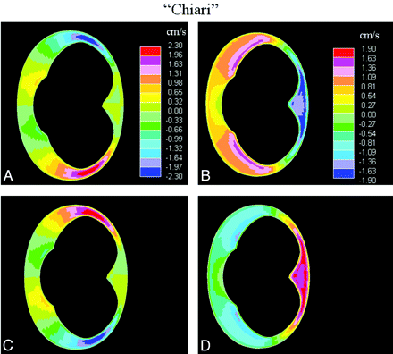 Fig 4.