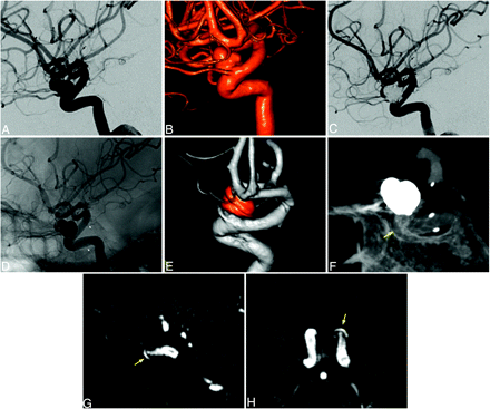 Fig 2.