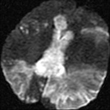 Fig 3.