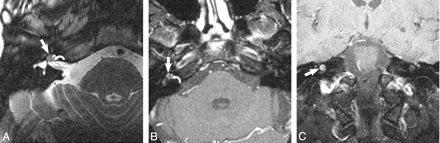 Fig 5.