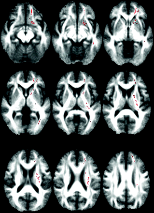 Fig 3.