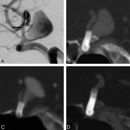 Fig 2.