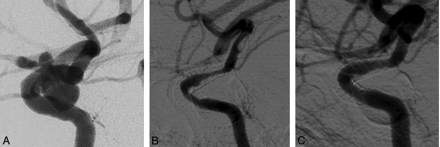 Fig 3.