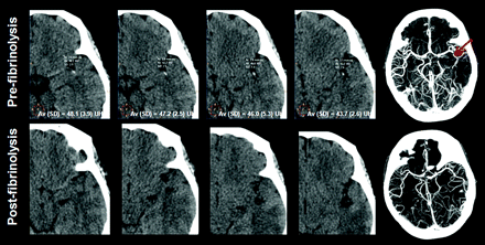 Fig 2.