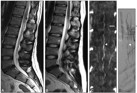 Fig 3.