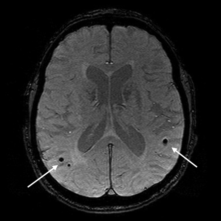 Fig 6.