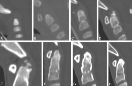 Fig 11.