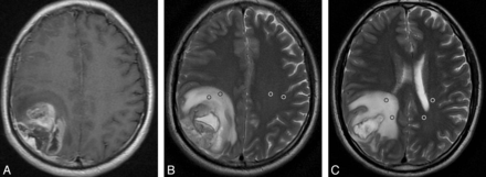 Fig 1.