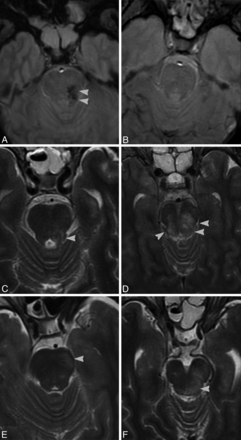 Fig 1.