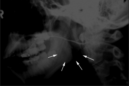 Fig 3.