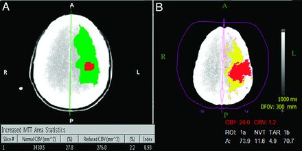 Fig 2.
