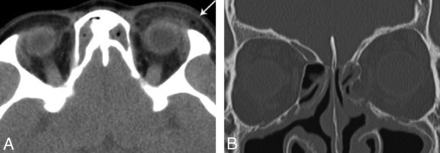 Fig 1.