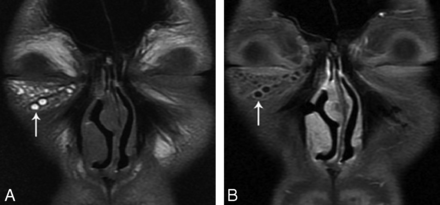 Fig 2.